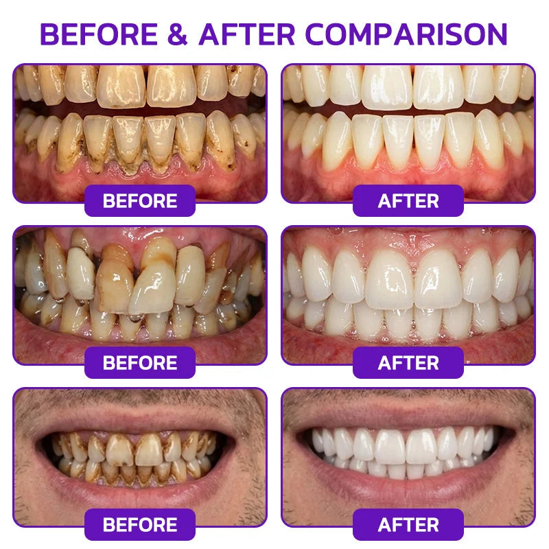 🦷VioCore Bee Venom Gingivitis & Periodontitis Treatment Toothpaste