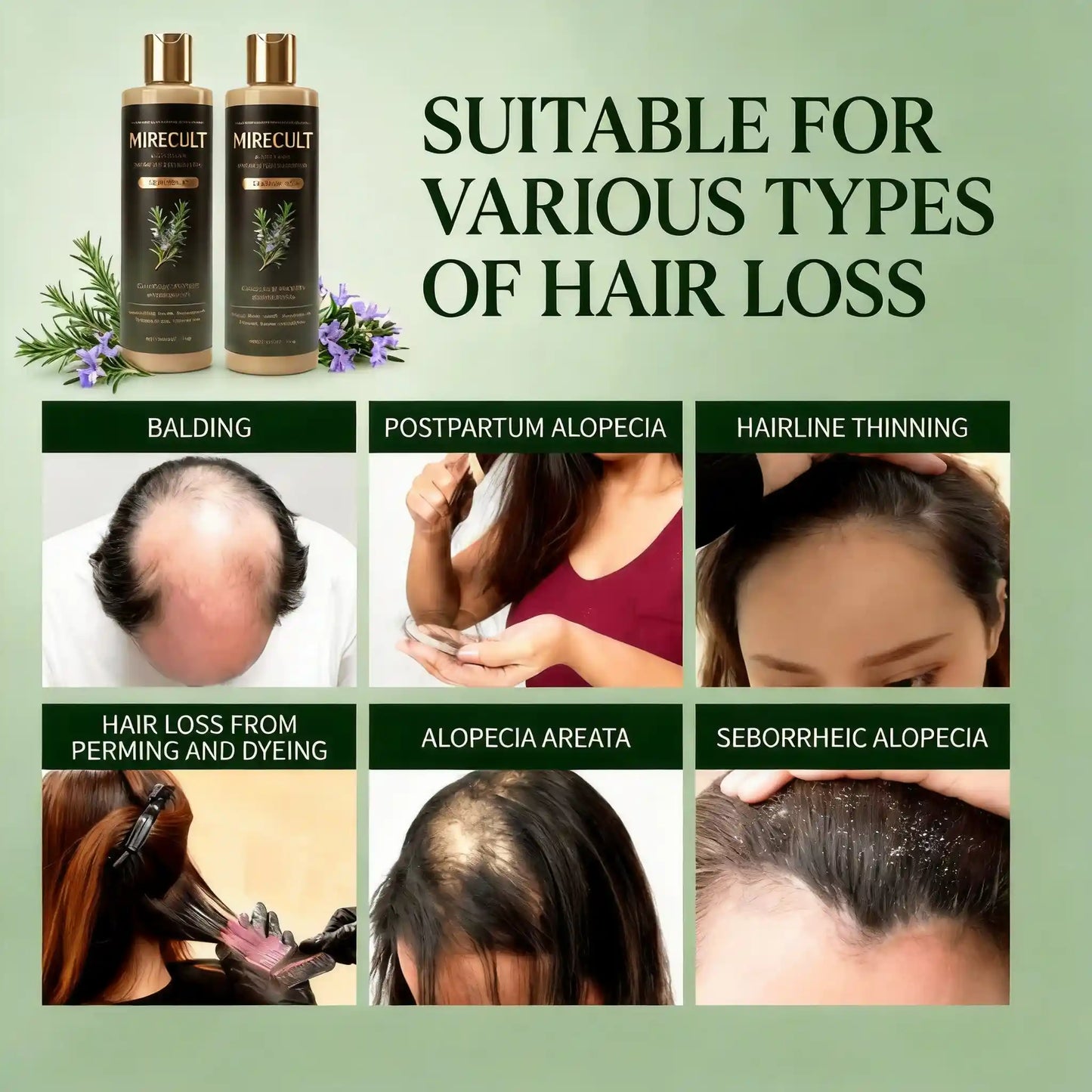 Mirecult🔥Organic Rosemary Shampoo | Reduces Breakage-Related Hair Loss
