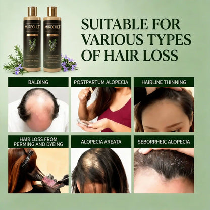 Mirecult🔥Organic Rosemary Shampoo | Reduces Breakage-Related Hair Loss