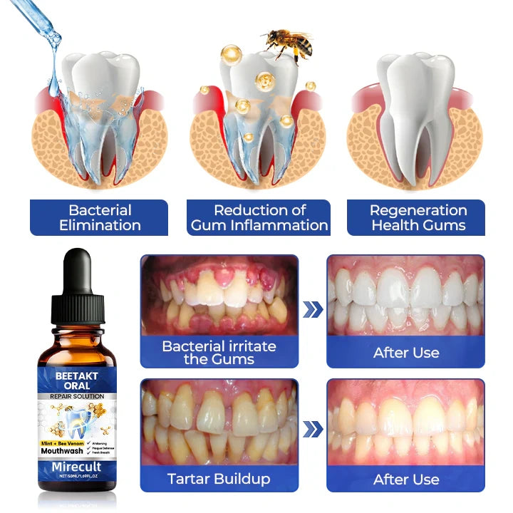 Mirecult® Oral Repair Drops|Supports Gum Health • Whitens Teeth • Removes Surface Stains