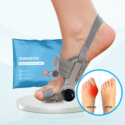 Bunion Corrector – Adjustable Toe Alignment Support for Daily Comfort