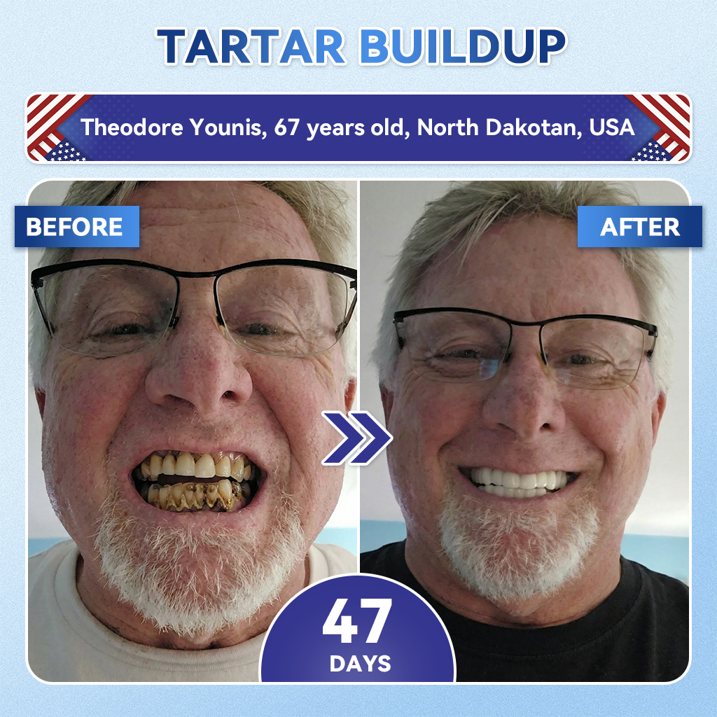 🦷 Tideglusib Fast‑Dissolving Tooth & Gum Repair Oral Strips ✨