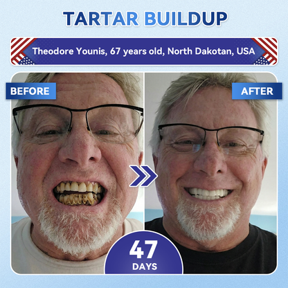 🦷 Tideglusib Fast‑Dissolving Tooth & Gum Repair Oral Strips ✨