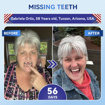 🦷 Tideglusib Fast‑Dissolving Tooth & Gum Repair Oral Strips ✨