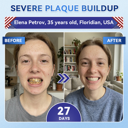 🦷 Tideglusib Fast‑Dissolving Tooth & Gum Repair Oral Strips ✨
