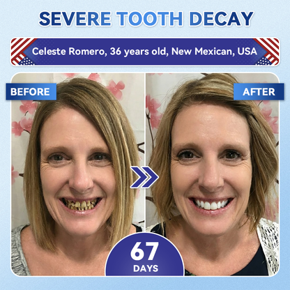 🦷 Tideglusib Fast‑Dissolving Tooth & Gum Repair Oral Strips ✨