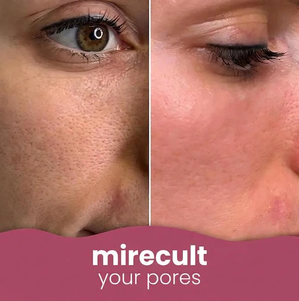 mirecult Brightening Turmeric & Kojic Acid Pads With anti-aging, hydrating, firming, lifting, skin-repairing, and spot-correcting benefits for a more even, clearer complexion.