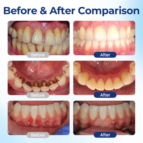 Mirecult® Oral Repair Drops|Supports Gum Health • Whitens Teeth • Removes Surface Stains