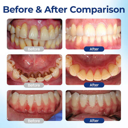 Mirecult® Oral Repair Drops|Supports Gum Health • Whitens Teeth • Removes Surface Stains