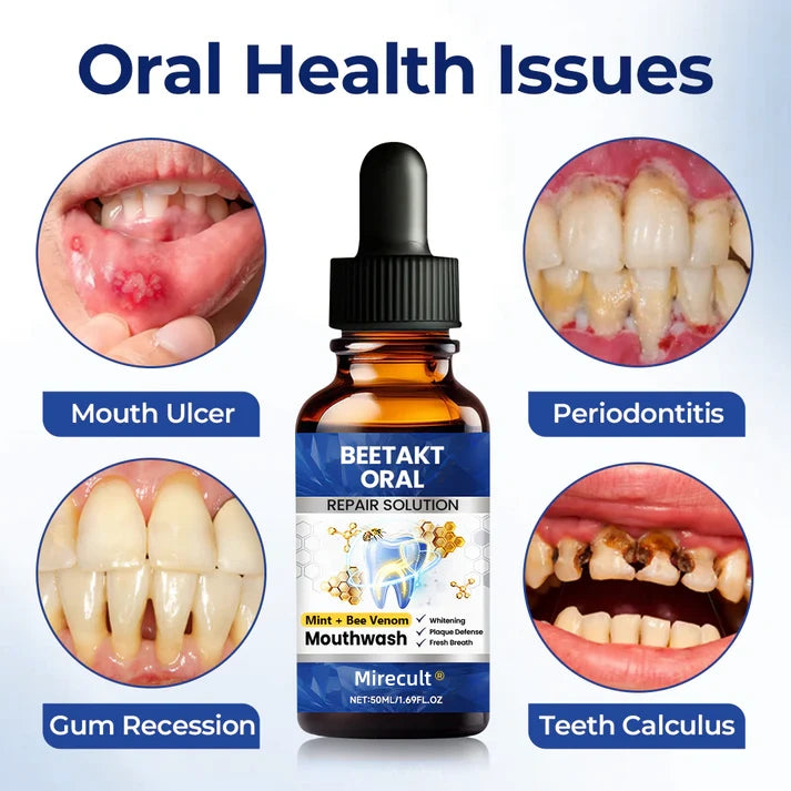 Mirecult® Oral Repair Drops|Supports Gum Health • Whitens Teeth • Removes Surface Stains
