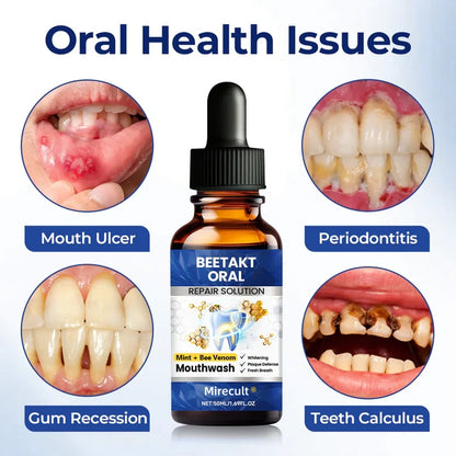 Mirecult® Oral Repair Drops|Supports Gum Health • Whitens Teeth • Removes Surface Stains