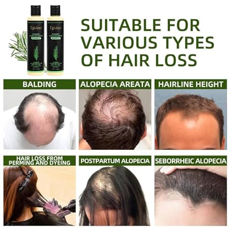 mirecult 🔥Organic Rosemary Hair Growth Shampoo