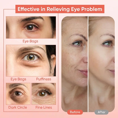 Mirecult MicroGlow Patches | Soothe eye area, reduce puffiness and fade wrinkles