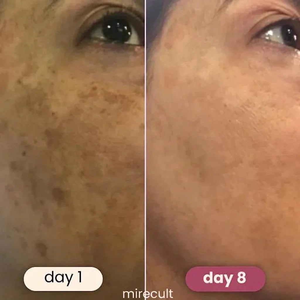 mirecult Brightening Turmeric & Kojic Acid Pads With anti-aging, hydrating, firming, lifting, skin-repairing, and spot-correcting benefits for a more even, clearer complexion.