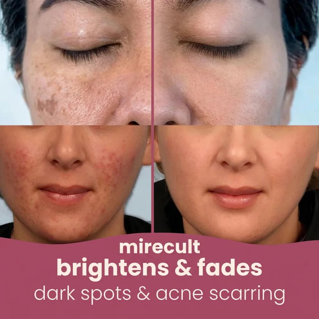mirecult Brightening Turmeric & Kojic Acid Pads With anti-aging, hydrating, firming, lifting, skin-repairing, and spot-correcting benefits for a more even, clearer complexion.