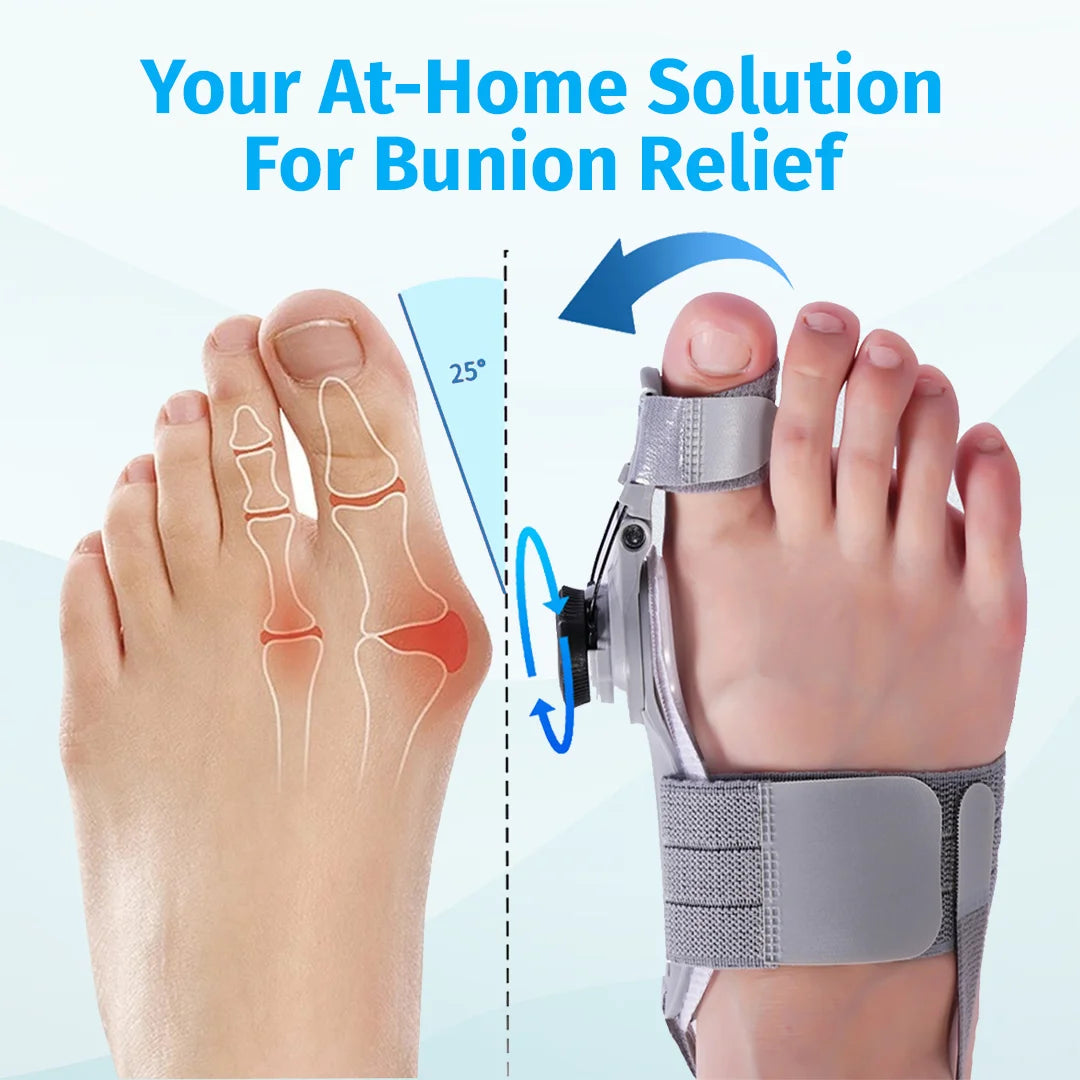 Bunion Corrector – Adjustable Toe Alignment Support for Daily Comfort