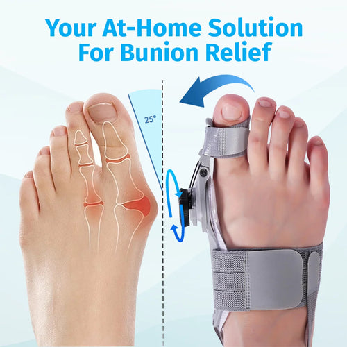Bunion Corrector – Adjustable Toe Alignment Support for Daily Comfort