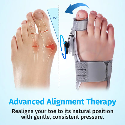 Bunion Corrector – Adjustable Toe Alignment Support for Daily Comfort