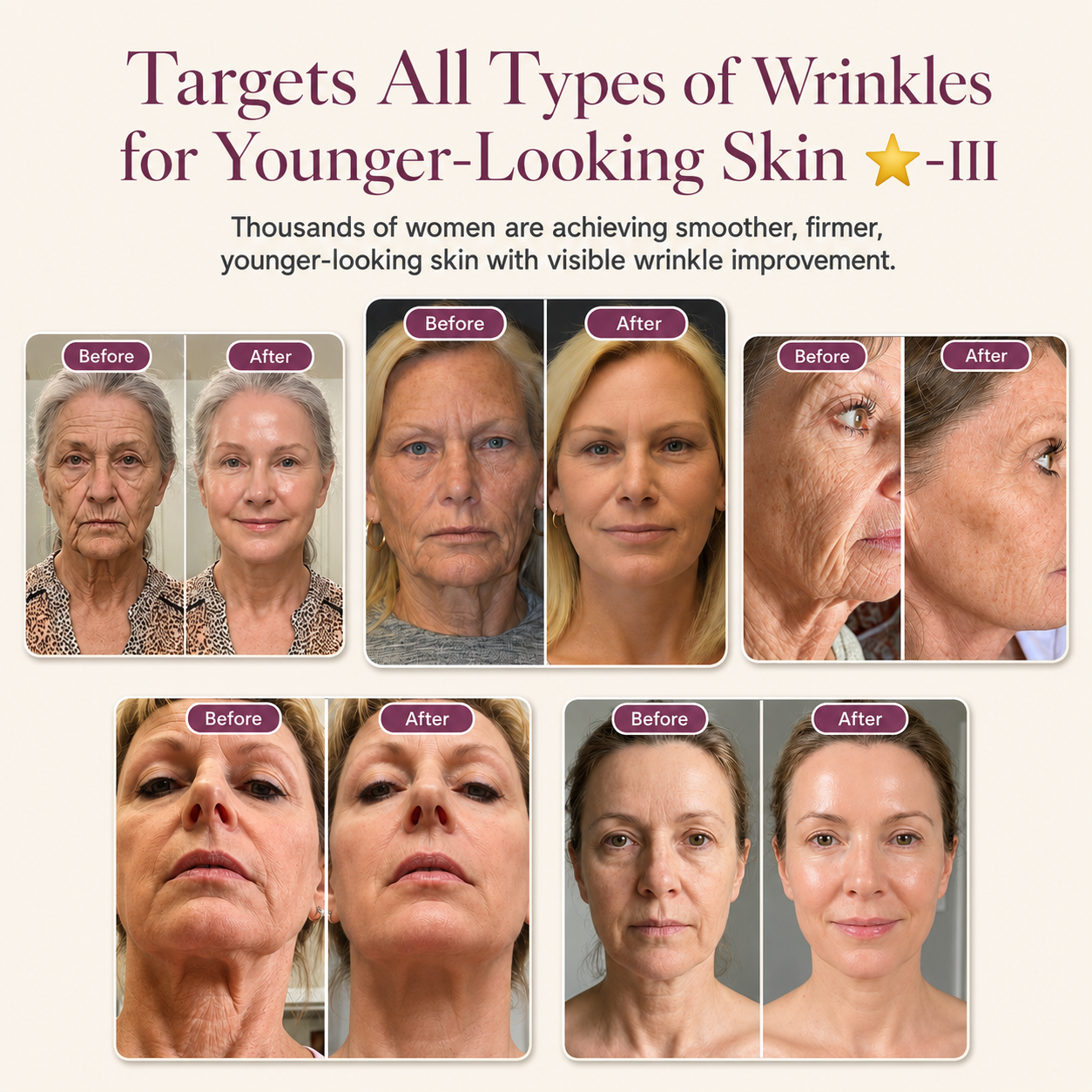 Targets All Types of Wrinkles for Younger-Looking Skin ⭐-III