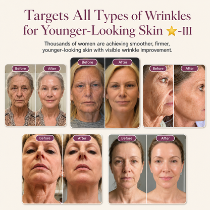 Targets All Types of Wrinkles for Younger-Looking Skin ⭐-III