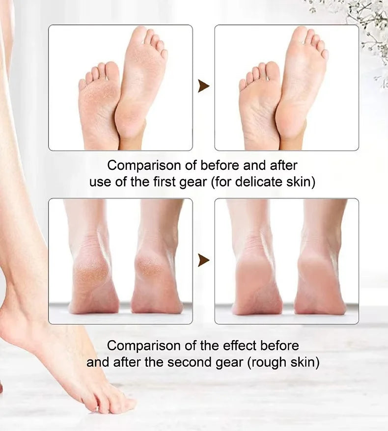 Flash Sale: 50% OFFRechargeable Electric Foot File Callus Remover with LED Display