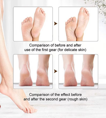 Flash Sale: 50% OFFRechargeable Electric Foot File Callus Remover with LED Display