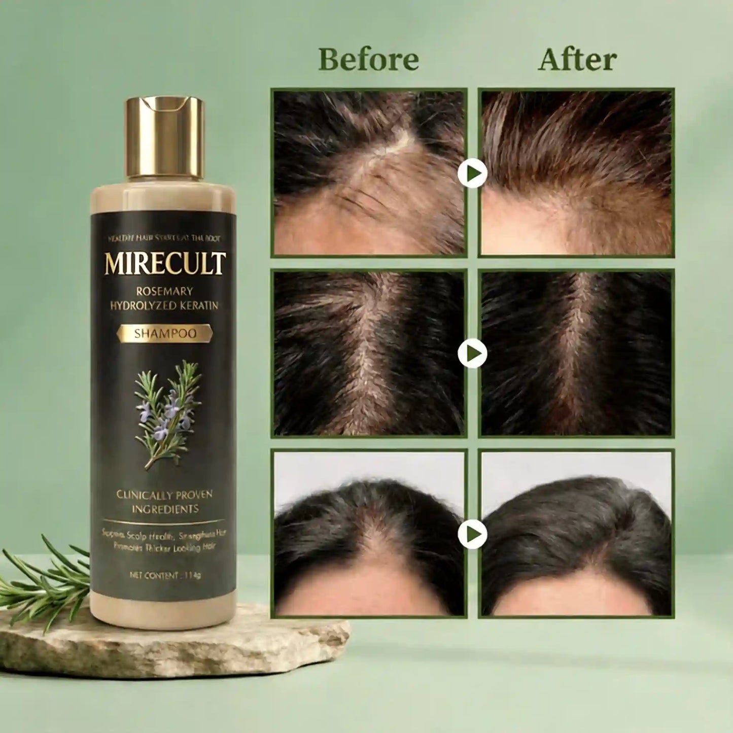 Mirecult🔥Organic Rosemary Shampoo | Reduces Breakage-Related Hair Loss