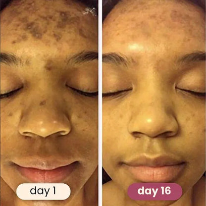 mirecult Brightening Turmeric & Kojic Acid Pads With anti-aging, hydrating, firming, lifting, skin-repairing, and spot-correcting benefits for a more even, clearer complexion.