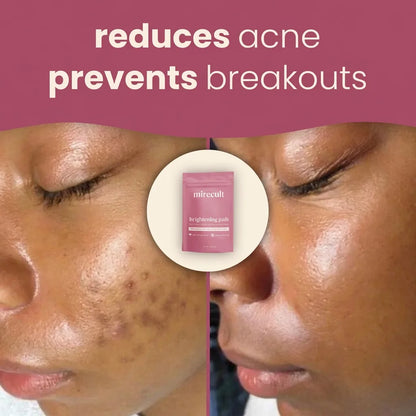 mirecult Brightening Turmeric & Kojic Acid Pads With anti-aging, hydrating, firming, lifting, skin-repairing, and spot-correcting benefits for a more even, clearer complexion.