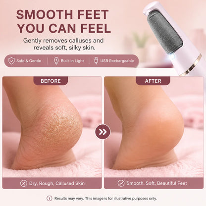 Flash Sale: 50% OFFRechargeable Electric Foot File Callus Remover with LED Display